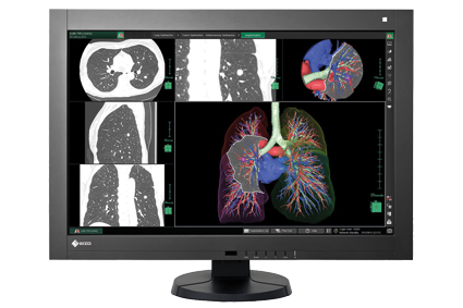 Profesjonalne monitory i oprogramowanie dla stacji medycznych